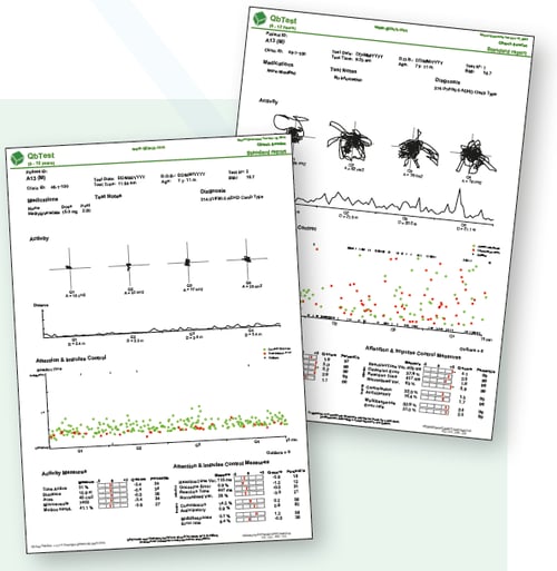 The Reality: Using QbTest Reports In Clinical Practice - Qbtech